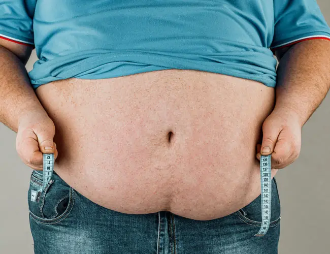 ¿Qué es la Cirugía Bariátrica?